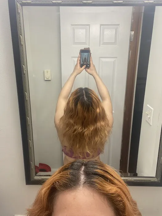 SCALP AND SKIN SOLUTIONS Picture 7