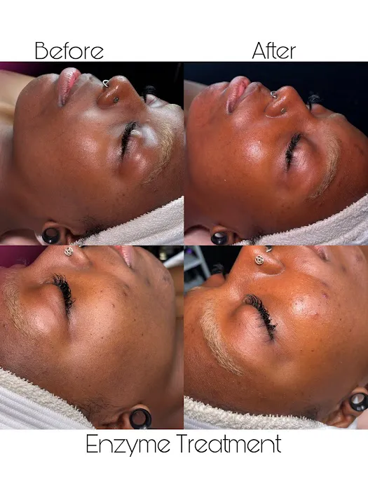 Beyond The Norm Esthetics Picture 6