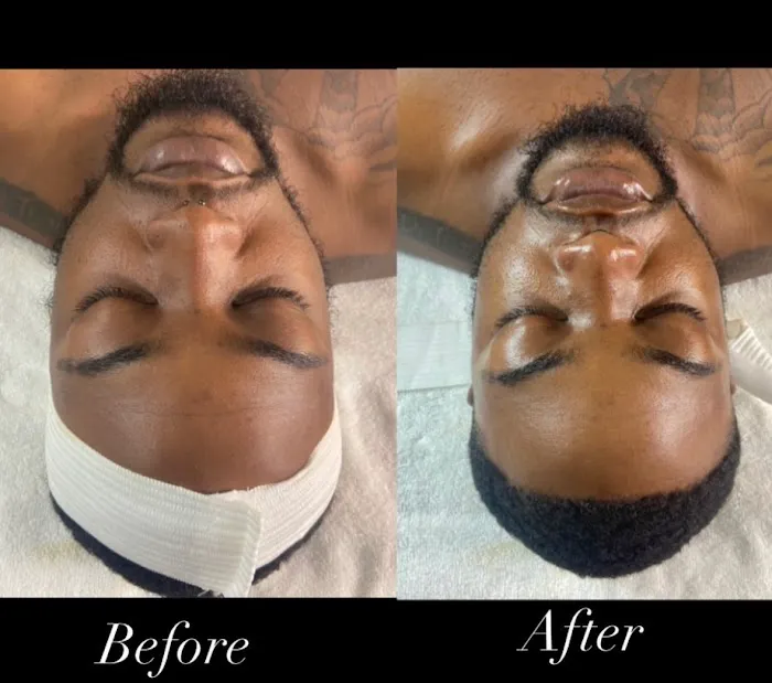 Beyond The Norm Esthetics Picture 2