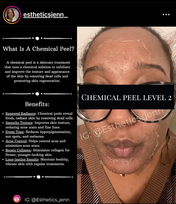 Beyond The Norm Esthetics Picture 3