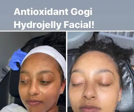 Lux Life Esthetics, LLC