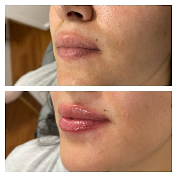 Timeless Injectables Picture 6