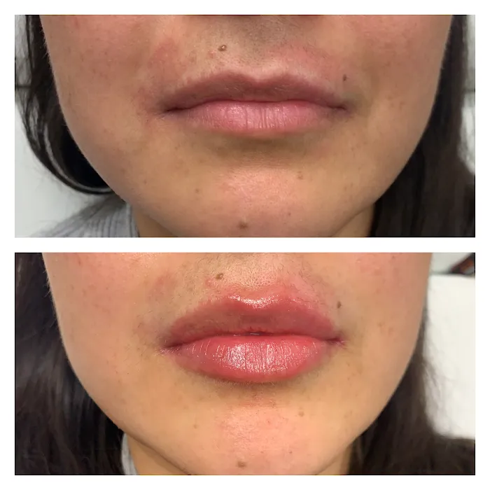 Timeless Injectables Picture 9