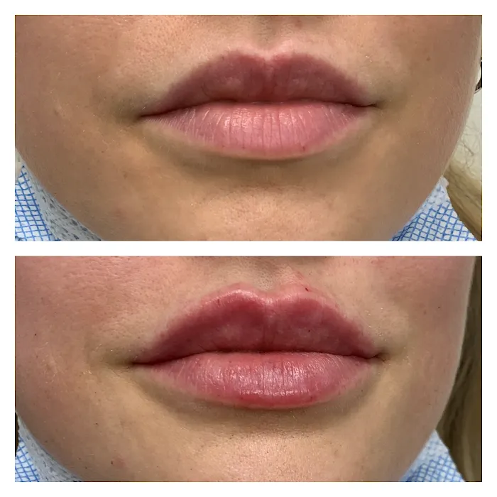 Timeless Injectables Picture 10