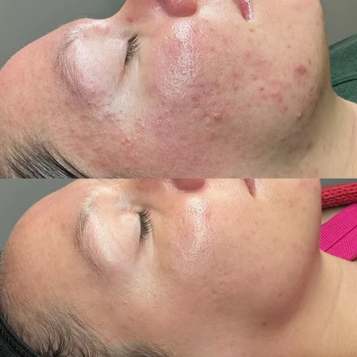 Mlaesthetics Picture 1