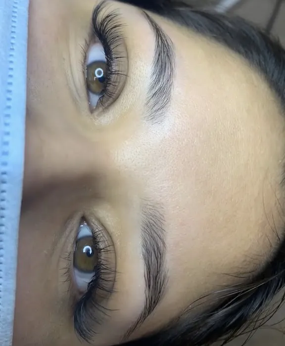 Mlaesthetics Picture 2