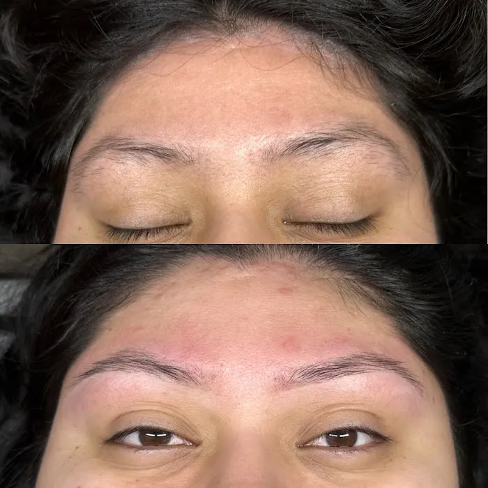 Mlaesthetics Picture 6