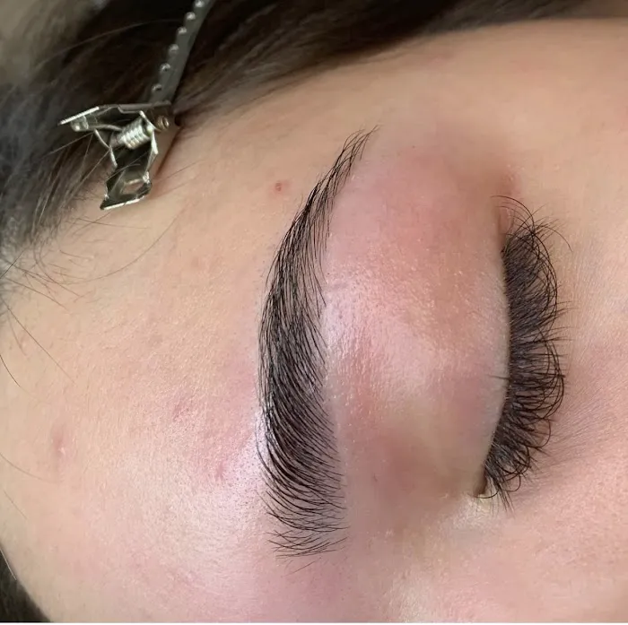 Mlaesthetics Picture 4