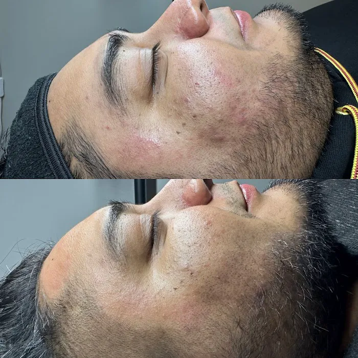 Mlaesthetics Picture 3