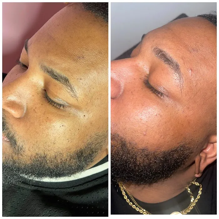 Clinical Complexions- Merrillville Facials+ Skintag Removal Picture 8