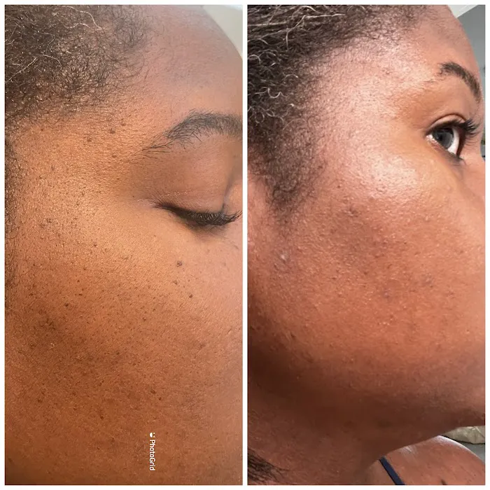 Clinical Complexions- Merrillville Facials+ Skintag Removal Picture 7