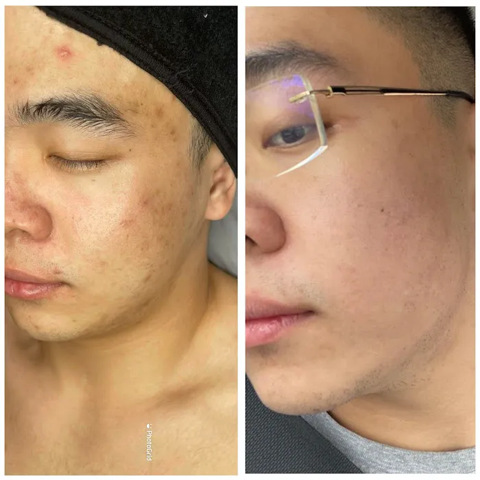 Clinical Complexions- Merrillville Facials+ Skintag Removal Picture 9