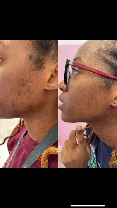 Clinical Complexions- Merrillville Facials+ Skintag Removal Picture 6