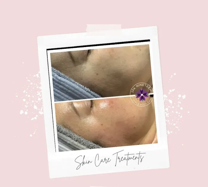 Spa Nineteen Picture 1