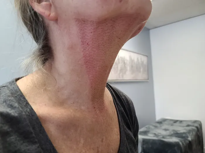 Xtreme Facials & More Picture 4