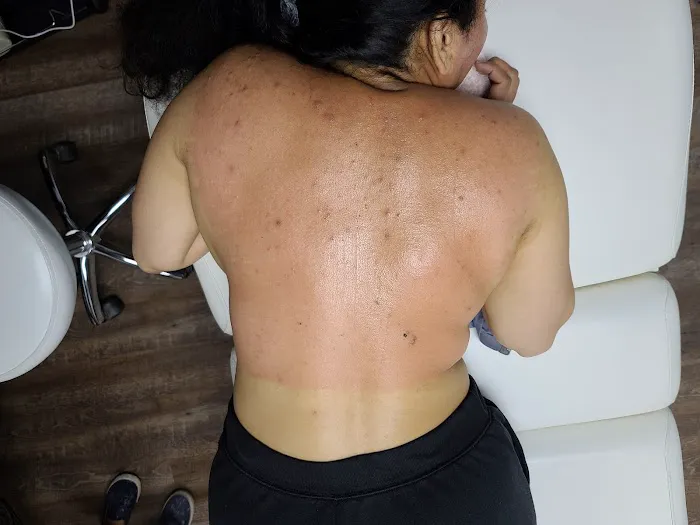 Xtreme Facials & More Picture 7