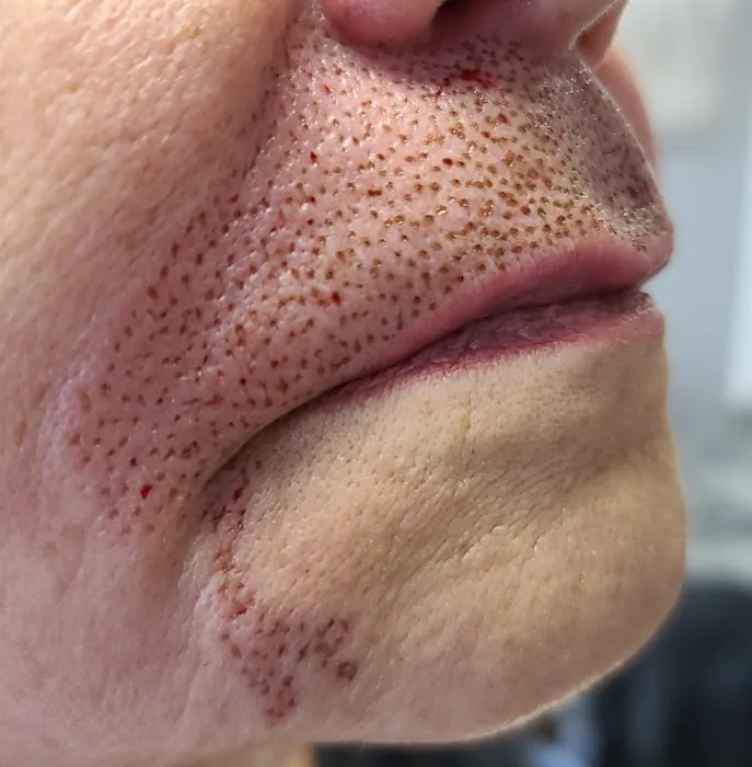 Xtreme Facials & More Picture 8