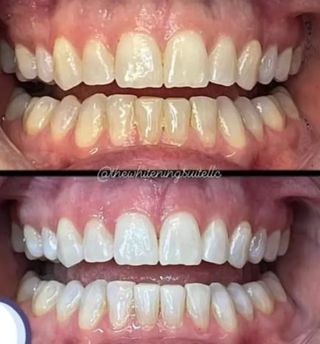 Xtreme Facials & More Picture 10