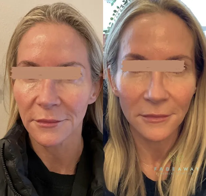 FadeAway Medical Esthetics Picture 3