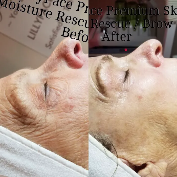 LillyFace Premium Skin Care Picture 1