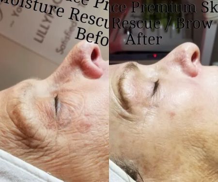 LillyFace Premium Skin Care