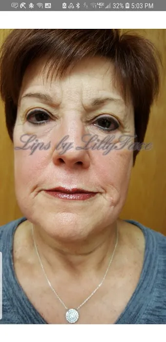 LillyFace Premium Skin Care Picture 2