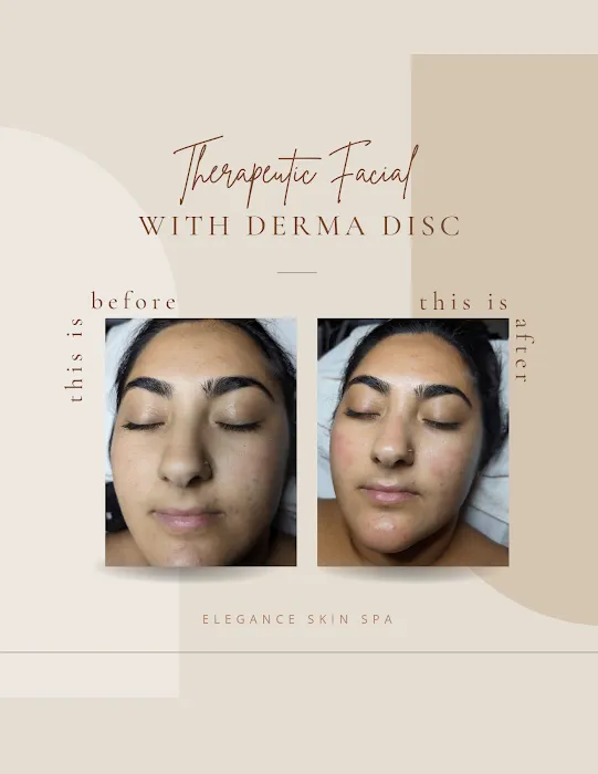 Kaleena Saulters Advanced Esthetics Picture 2