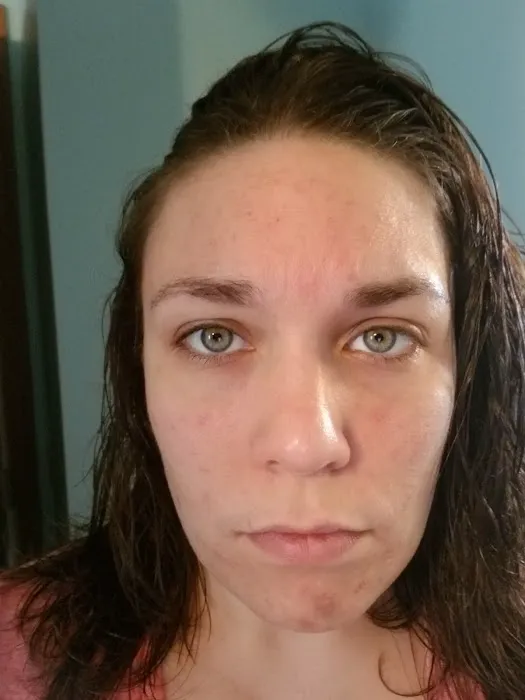 Applegarth Dermatology, PC Picture 2