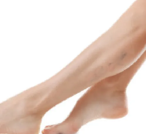 University Dermatology and Vein Clinic Picture 3