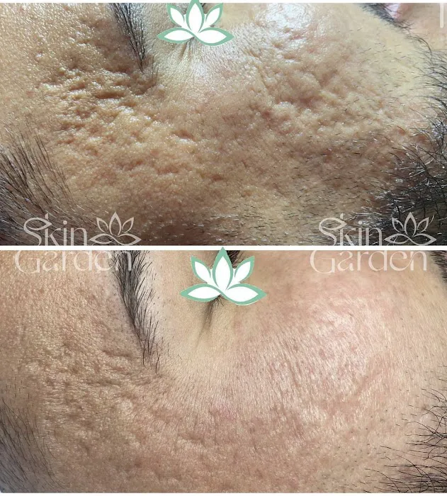 Skin Garden Addison Picture 7