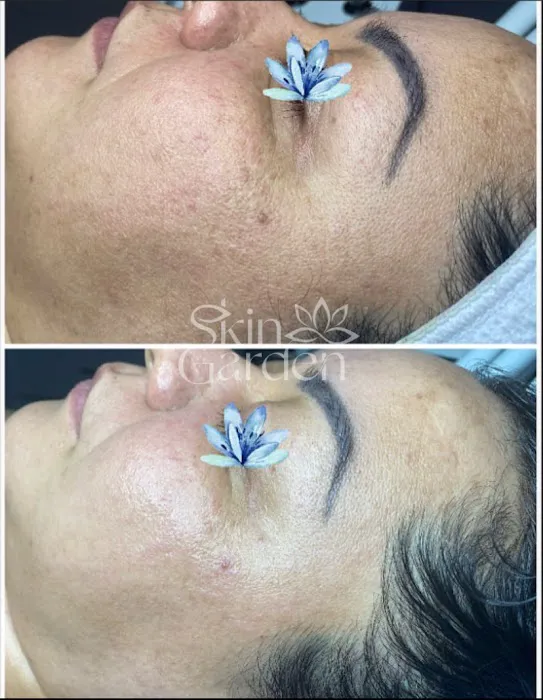 Skin Garden Addison Picture 5