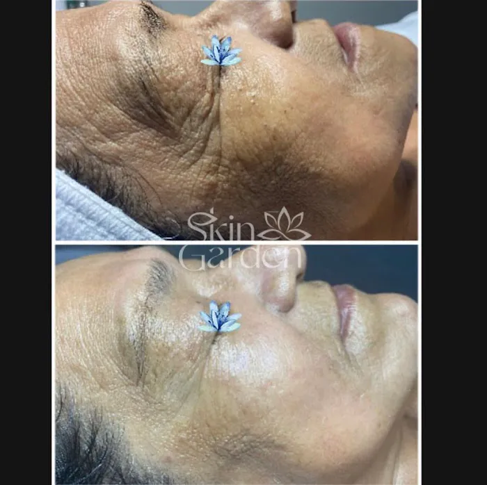 Skin Garden Addison Picture 8