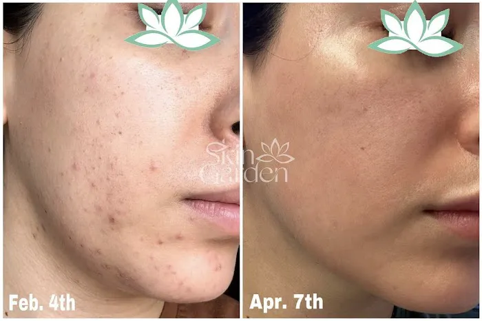 Skin Garden Addison Picture 9