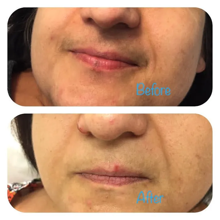 Maggie’s Laser Skin Care Picture 5