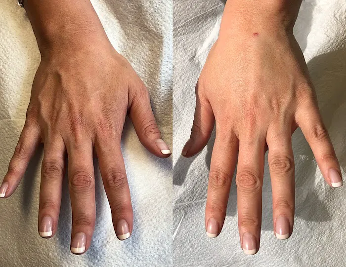 Aesthetic Skin Winnetka Picture 6