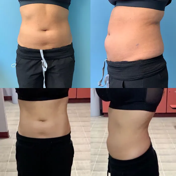 Aesthetic Skin Winnetka Picture 8