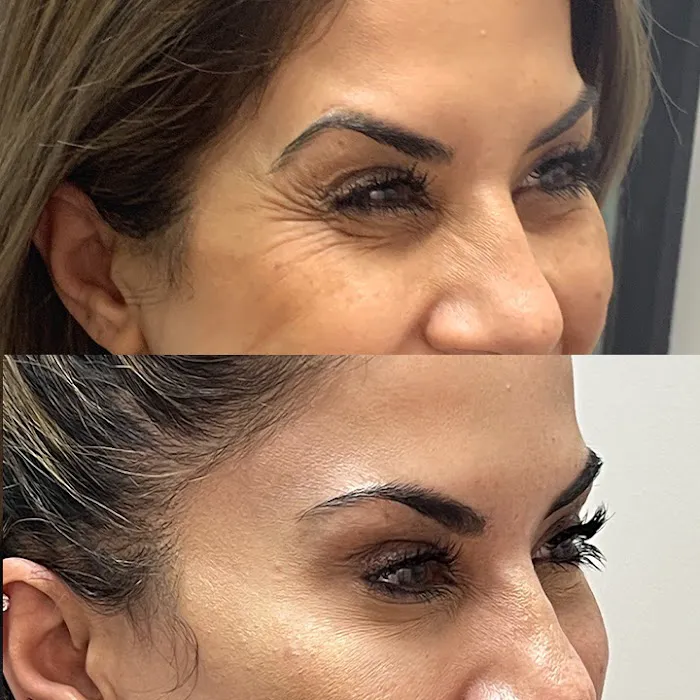 Aesthetic Skin Winnetka Picture 5