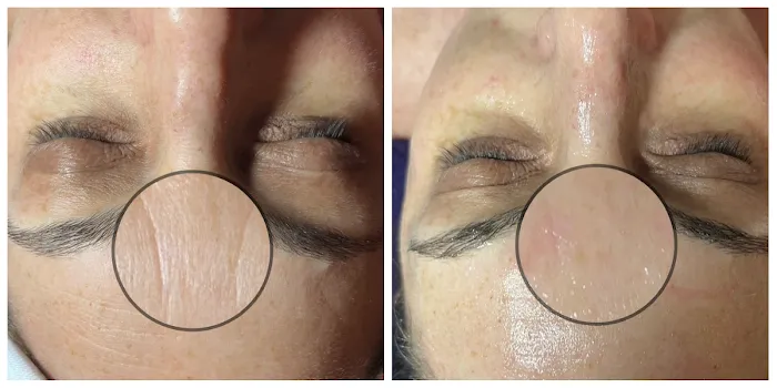 Silky Smooth Waxing Studio Picture 9