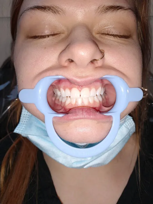 Skinpeach Skin Tightening and Natural Teeth Whitening Picture 3