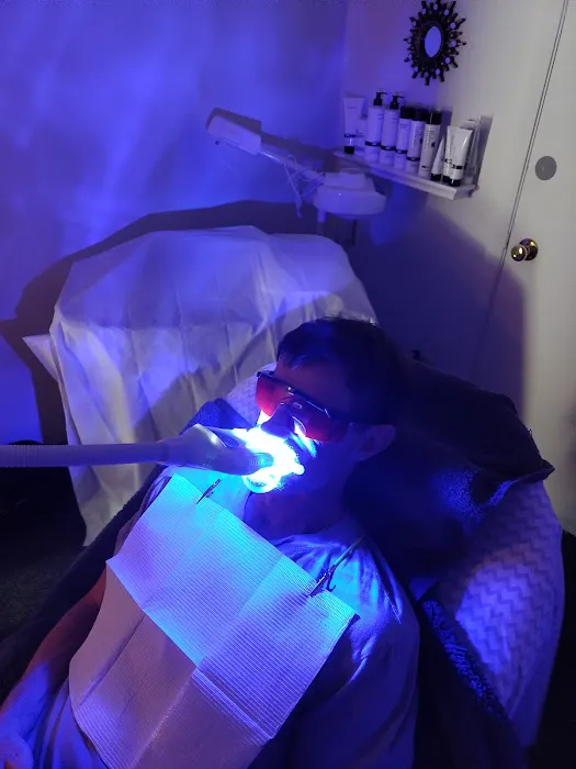 Skinpeach Skin Tightening and Natural Teeth Whitening Picture 5