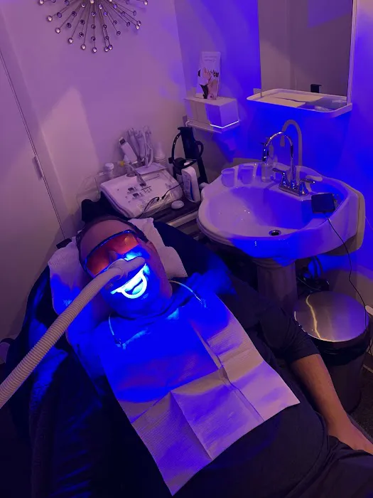 Skinpeach Skin Tightening and Natural Teeth Whitening Picture 9