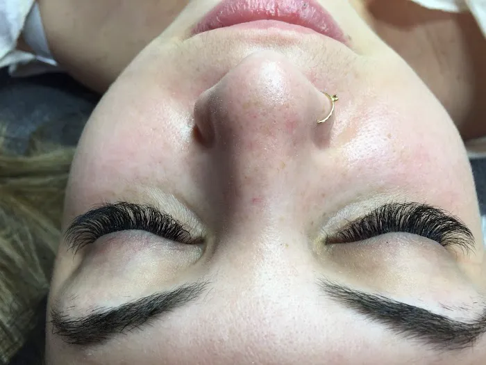 Blue Lotus Aesthetics Picture 3