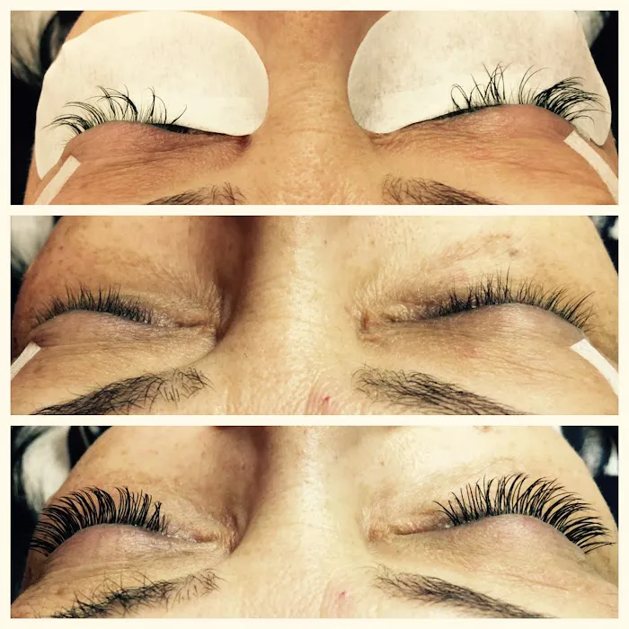 Blue Lotus Aesthetics Picture 7