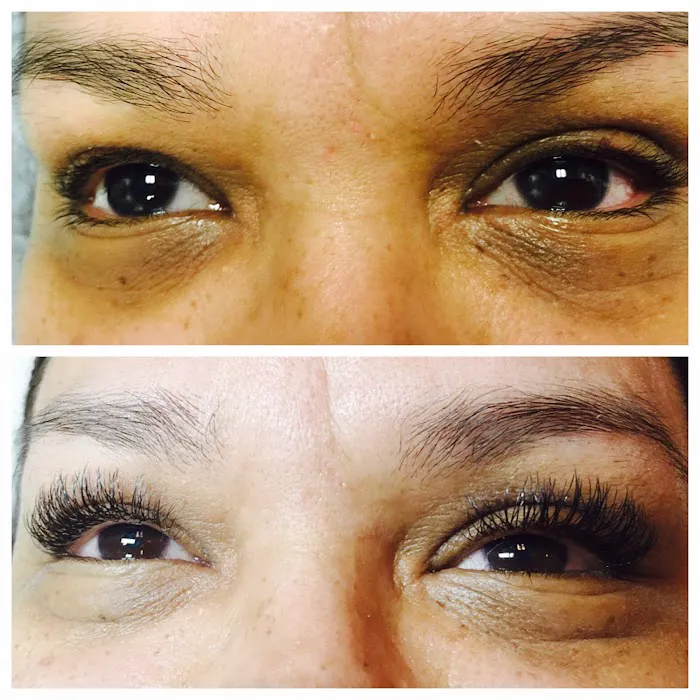 Blue Lotus Aesthetics Picture 8