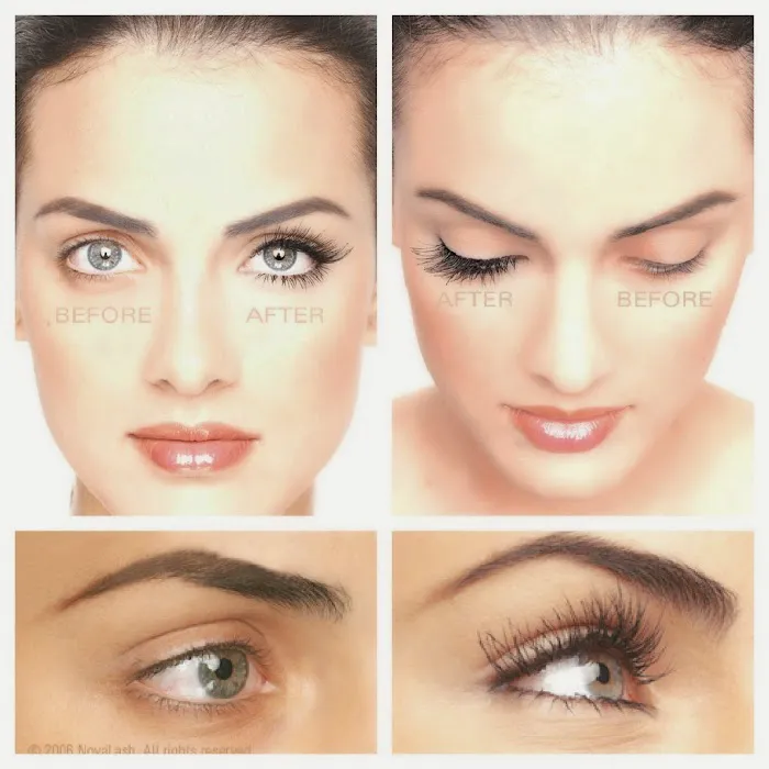 Blue Lotus Aesthetics Picture 10