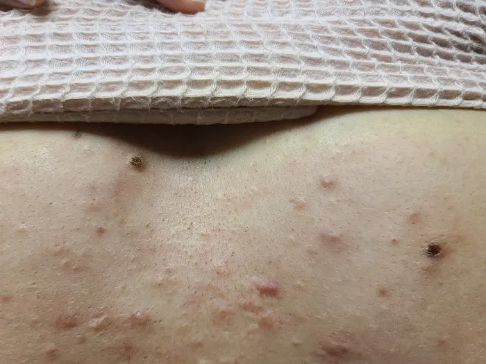 Xtreme Facials & More Picture 4