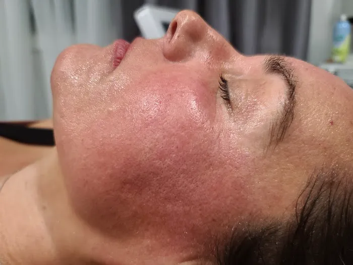 Xtreme Facials & More Picture 8