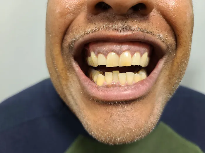 Xtreme Facials & More Picture 5