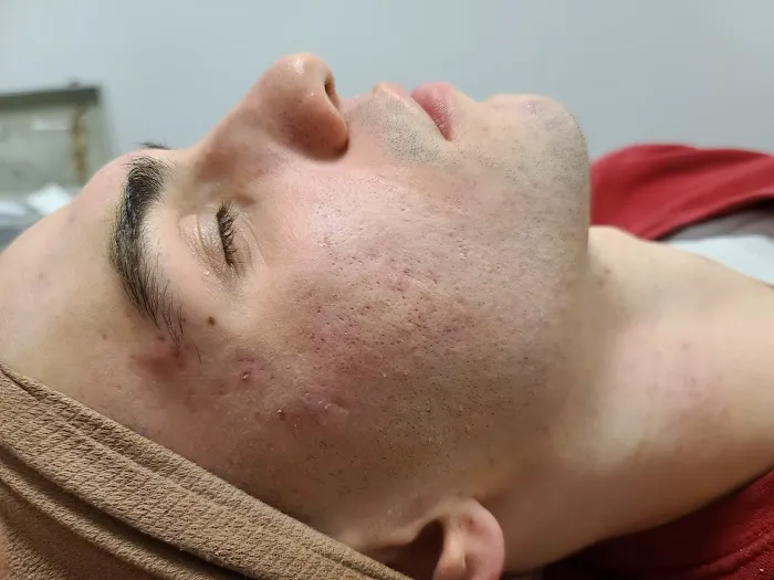 Xtreme Facials & More Picture 9