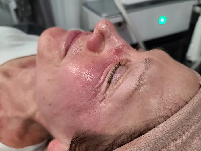 Xtreme Facials & More Picture 10